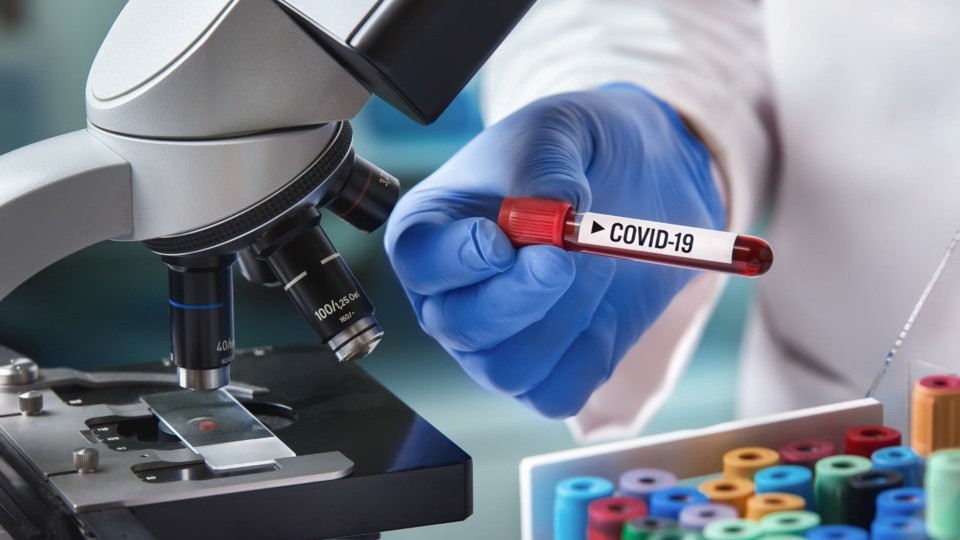 Тесты на специфические антитела к коронавирусу в клинике "ВолховМед"